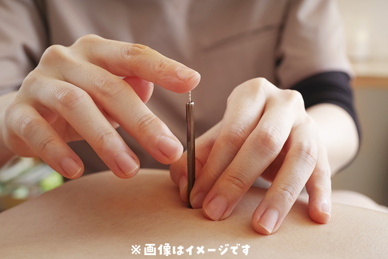 訪問鍼灸のイメージ画像