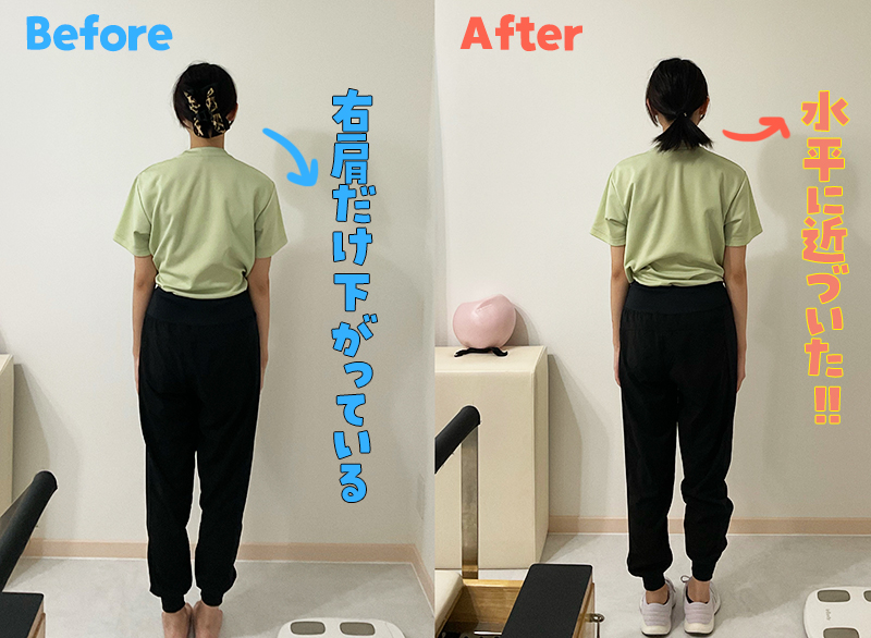 姿勢のビフォーアフター